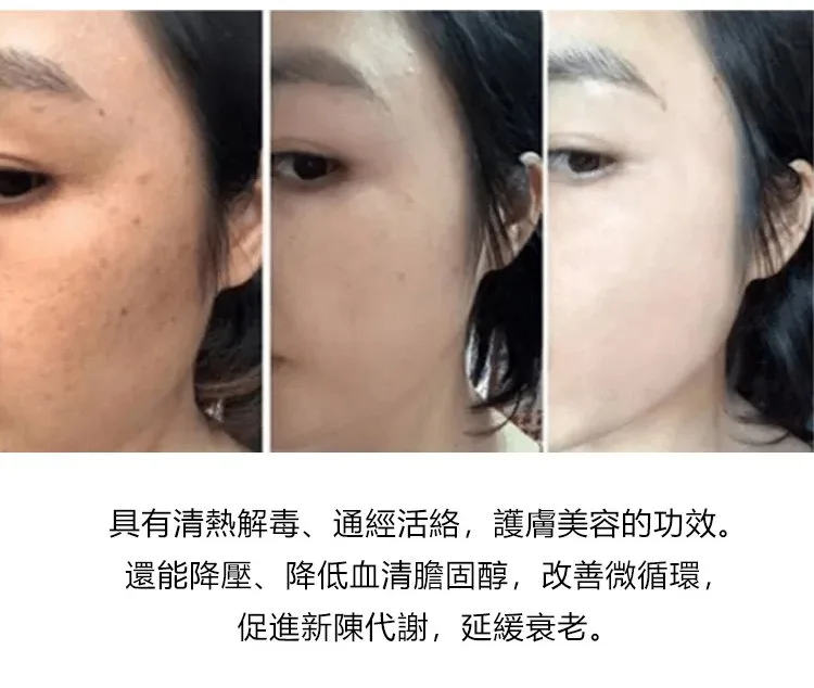 🥢 老壇枸杞泡薑芽|酸甜爽脆超開胃 一口接一口停不下來 - 23