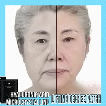 ✨【法令紋魔貼】奇跡降臨！日本獨創逆齡煉金技術，對抗地心引力，7天消除法令紋，瞬間逆轉時間！5天內銷售1萬盒！揭秘青春的秘密，讓你重返青春，驚艷全場！限時買一送三，貨到付款+全台免運！✨ - 14