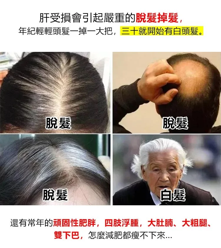 🥢 老壇枸杞泡薑芽|酸甜爽脆超開胃 一口接一口停不下來 - 4