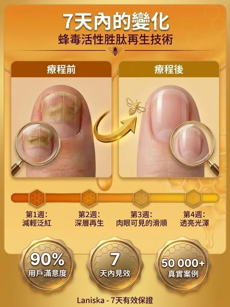 💅【SouthMoon紐西蘭蜂毒生技】蜂毒美甲修護液🔥告別厚黃灰指甲困擾|深層滲透養護指甲環境|重拾乾淨透亮美甲狀態✨ 🌿 蜂毒植萃精華配方|快速滲透指甲表層 ✨ 告別粗糙厚重感|恢復自然細緻外觀 💧 每日輕鬆塗抹|居家護理簡單方便 - 14