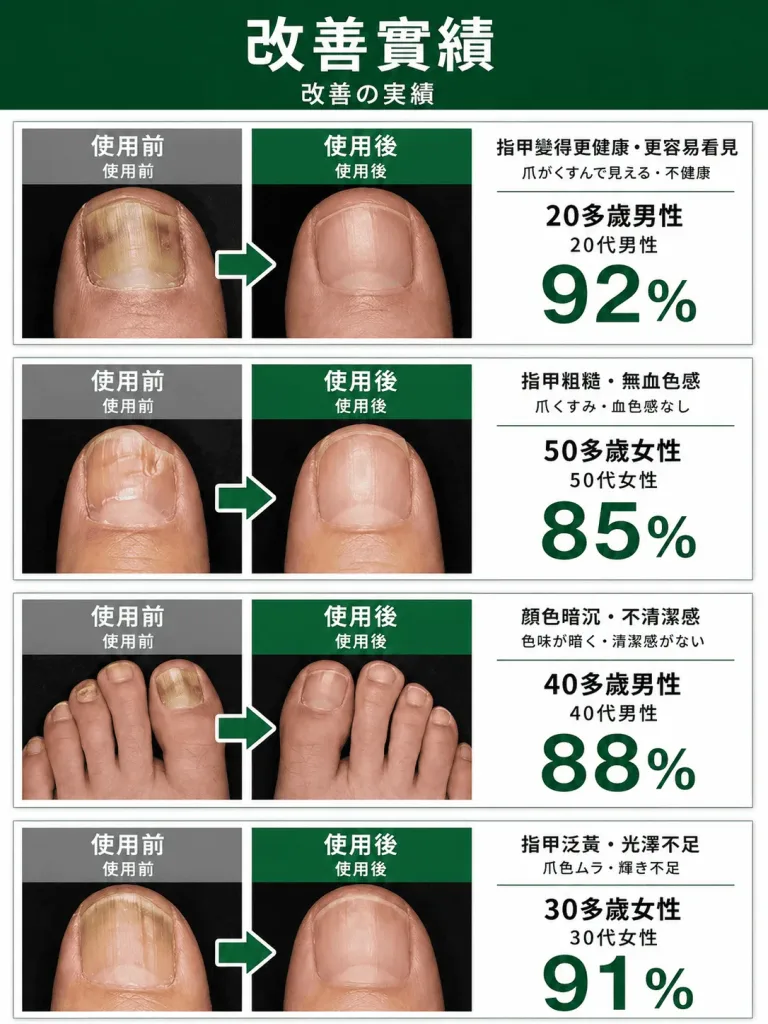 💧【日本研發修護🌿口碑推薦】 ✨專業級指甲養護精華✨ 清爽快乾質地 形成防護膜 防水不黏膩 搭配專用刷頭 精準塗抹更方便 日常呵護腳趾與手指甲 維持自然光澤 愛穿包鞋 常泡湯族群超適合 - 9