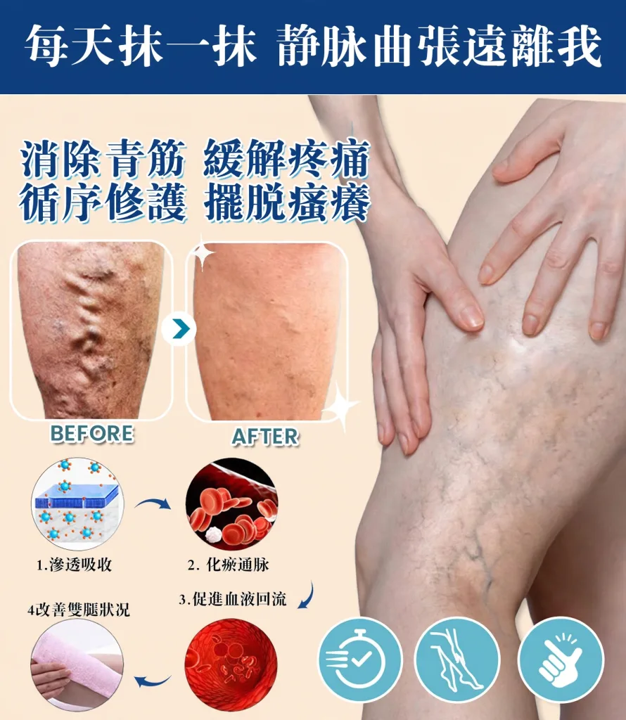 🌿【曲張脈通凝膠】植物萃取清涼護理 久站久坐後腿部容易疲憊？ 輕輕塗抹按摩 帶來清爽放鬆感 上班族 運動後 日常腿部保養好選擇 - 6