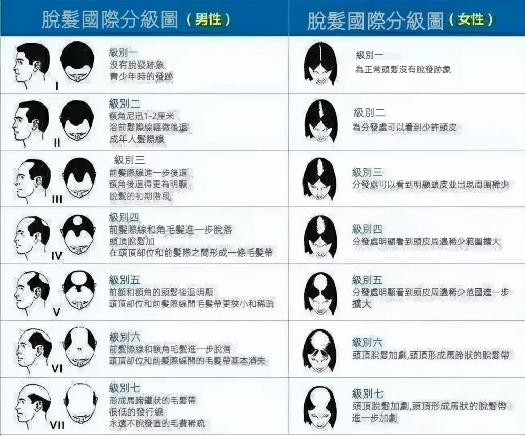 🌿【植萃養髮精華液】滋養頭皮・強韌髮根・打造豐盈秀髮質感 - 28
