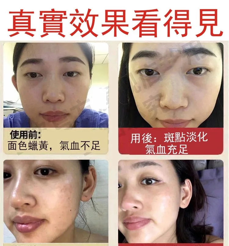 🔥【古法紅糖薑片】老話說「冬吃蘿蔔 夏吃薑,不勞醫生開藥方」!嚴選老薑搭配古法紅糖慢火熬製,薑香濃郁、暖暖入喉。天天沖一杯,驅寒暖身、祛濕排毒、補氣養血,手腳冰冷、氣色差、容易疲倦的人都愛喝。早餐一杯、睡前一杯,全身暖呼呼、精神更有勁,男女老少四季都適合,家中一定要常備! - 17