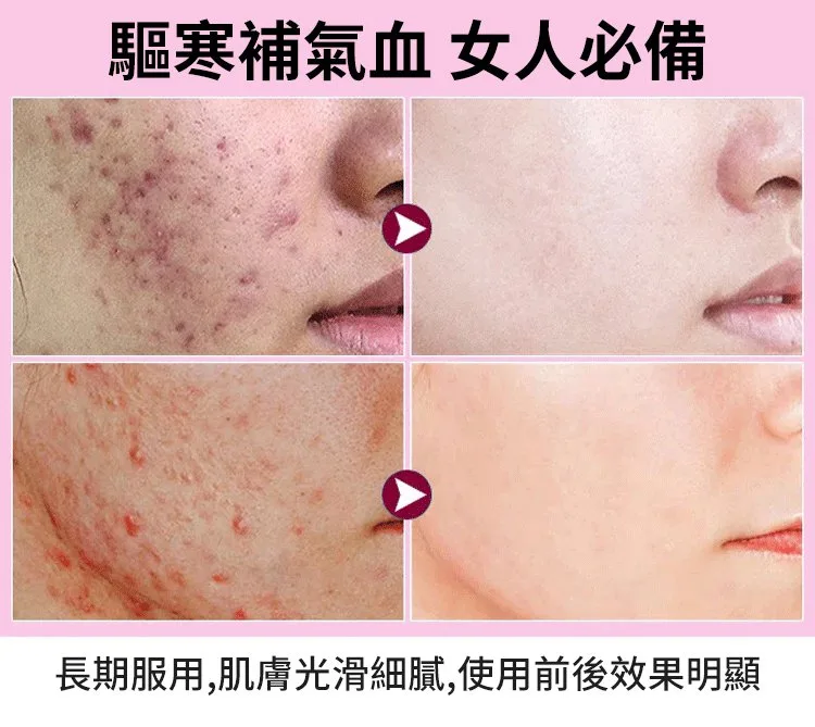 🔥【古法紅糖薑片】老話說「冬吃蘿蔔 夏吃薑,不勞醫生開藥方」!嚴選老薑搭配古法紅糖慢火熬製,薑香濃郁、暖暖入喉。天天沖一杯,驅寒暖身、祛濕排毒、補氣養血,手腳冰冷、氣色差、容易疲倦的人都愛喝。早餐一杯、睡前一杯,全身暖呼呼、精神更有勁,男女老少四季都適合,家中一定要常備! - 14