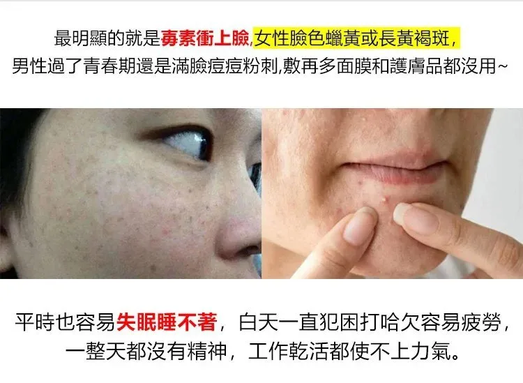 【台北頤和堂】葛根靈芝片 肝的問題刻不容緩 明目 排毒 去火 純中醫配方無危害 科學養護您的肝的健康! - 11