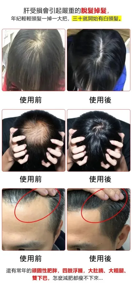 【台北頤和堂】葛根靈芝片 肝的問題刻不容緩 明目 排毒 去火 純中醫配方無危害 科學養護您的肝的健康！ - 13