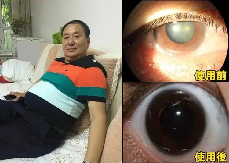 眼睛痠脹、乾澀、疲勞?醫視寳E視力眼貼:一貼舒緩,雙眼重獲清新 - 8