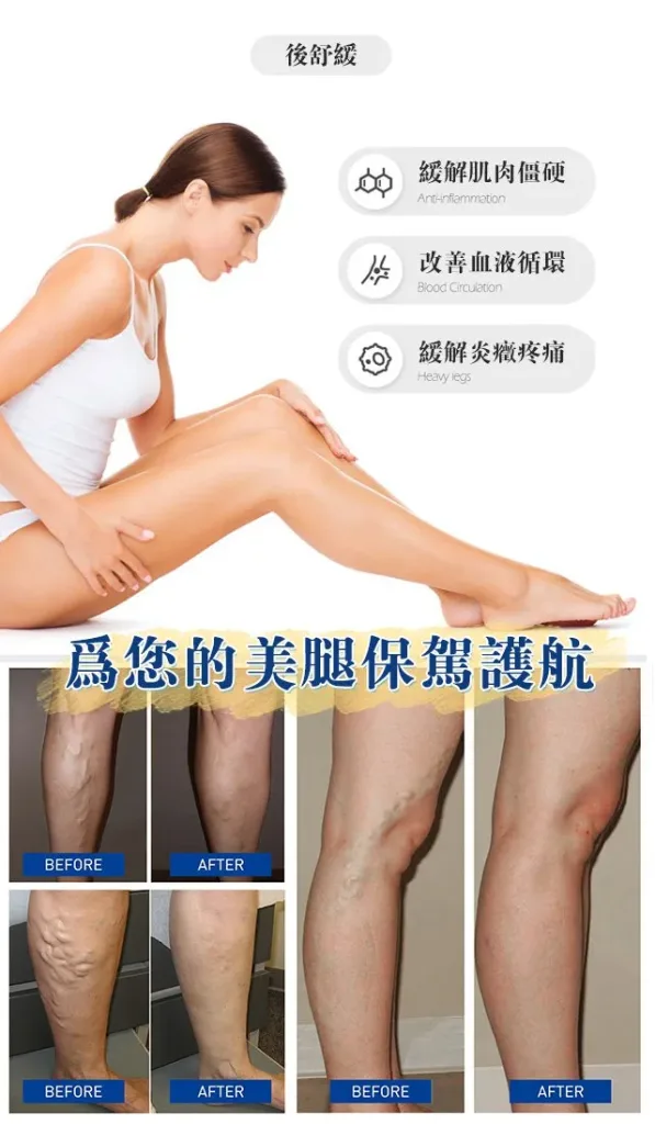 🌿【曲張脈通凝膠】植物萃取清涼護理 久站久坐後腿部容易疲憊？ 輕輕塗抹按摩 帶來清爽放鬆感 上班族 運動後 日常腿部保養好選擇 - 8