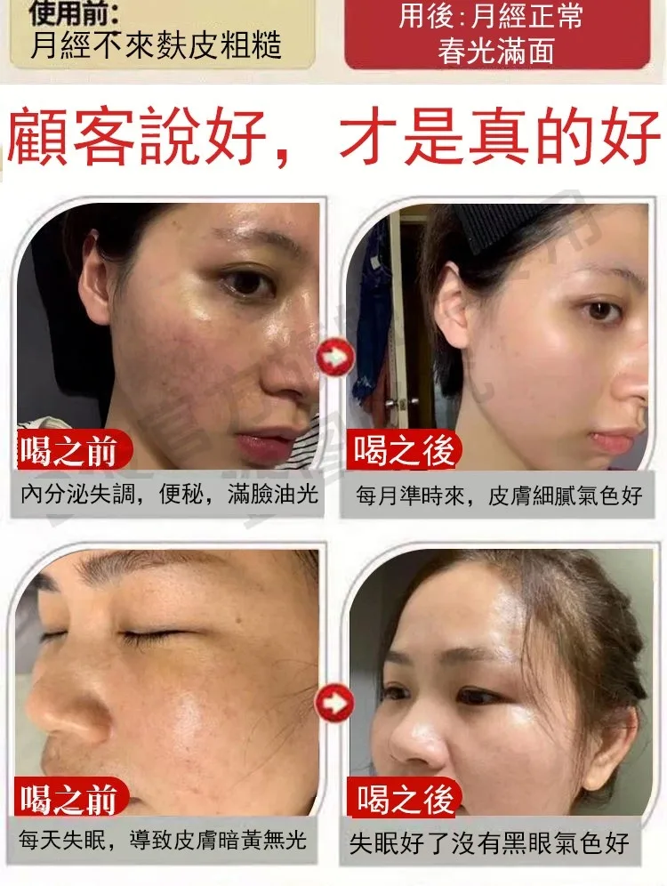 🔥【古法紅糖薑片】老話說「冬吃蘿蔔 夏吃薑,不勞醫生開藥方」!嚴選老薑搭配古法紅糖慢火熬製,薑香濃郁、暖暖入喉。天天沖一杯,驅寒暖身、祛濕排毒、補氣養血,手腳冰冷、氣色差、容易疲倦的人都愛喝。早餐一杯、睡前一杯,全身暖呼呼、精神更有勁,男女老少四季都適合,家中一定要常備! - 18